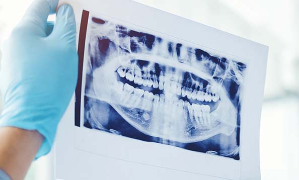 Looking at dental x-ray
